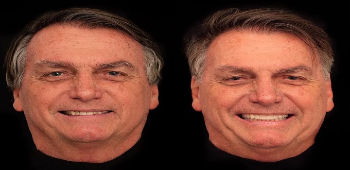 Bolsonaro coloca lentes de contato nos dentes: 'vaidade não faz mal a ninguém'; vídeo
