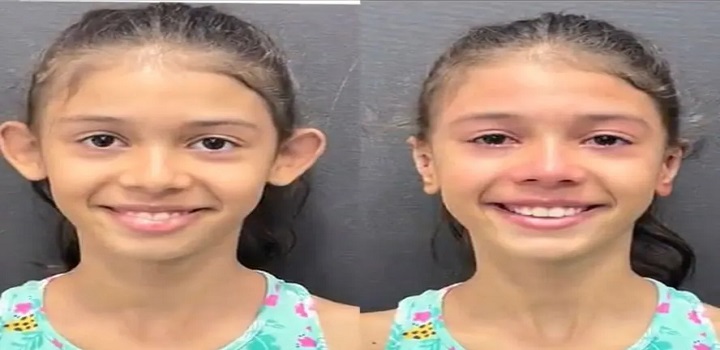 Menina se emociona ao ver resultado da procedimento para correção das suas orelhas; entenda como funciona; veja vídeo