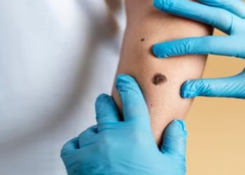 vacina câncer de pele