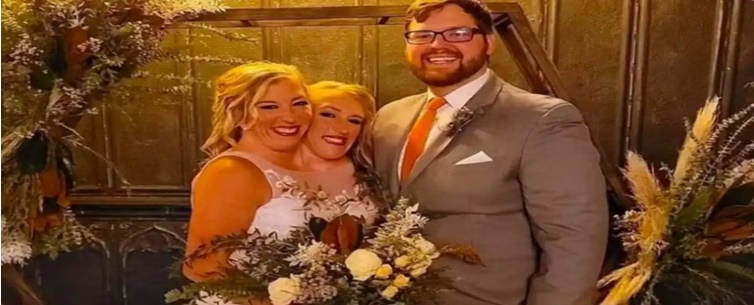 Enfermeiro se casa com uma das gêmeas siamesas estrelas da TV