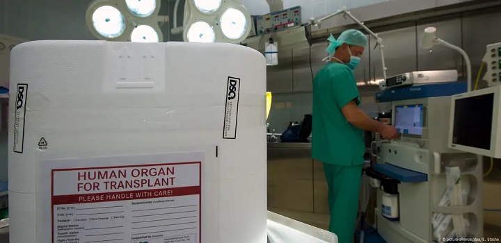 hiv transplantes
