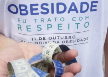 Resolução autoriza procedimento em adolescentes com obesidade grave e amplia critérios também para adultos; banda gástrica e cirurgia de Scopinaro deixam de ser recomendadas.