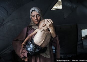 Reportagem do NY Times revela crise extrema em hospitais de Gaza: médicos desmaiam de fome, bebês recebem apenas água e desnutrição atinge 900 mil crianças