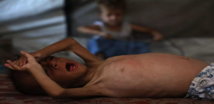 fome em gaza