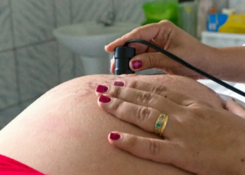 Pesquisa Nascer no Brasil 2 aponta redução de episiotomia e manobra de Kristeller, mas cesarianas e falhas no pré-natal ainda preocupam no Brasil e no Rio de Janeiro.