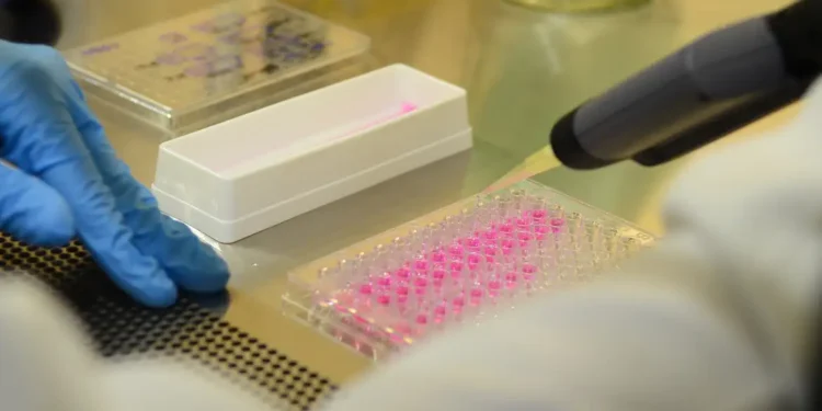 Estudo de Stanford mostra que o córtex entorrinal medial se degrada com a idade e pode ser chave no avanço do Alzheimer.