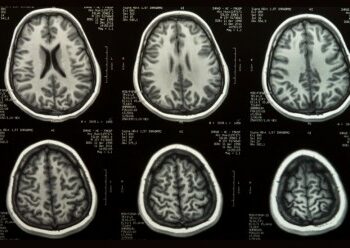Pesquisa publicada na Science Advances indica que o cérebro reforça lembranças quando há ligação emocional. Descoberta abre caminho para tratamentos e novas estratégias de aprendizagem.