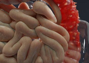 Entenda a diverticulite: inflamação silenciosa que pode virar emergência