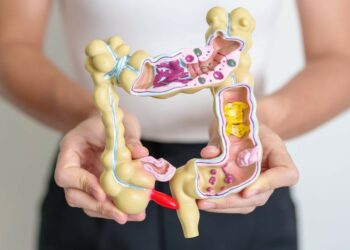 Alterações intestinais, anemia e perda de peso podem indicar câncer colorretal, alertam especialistas.