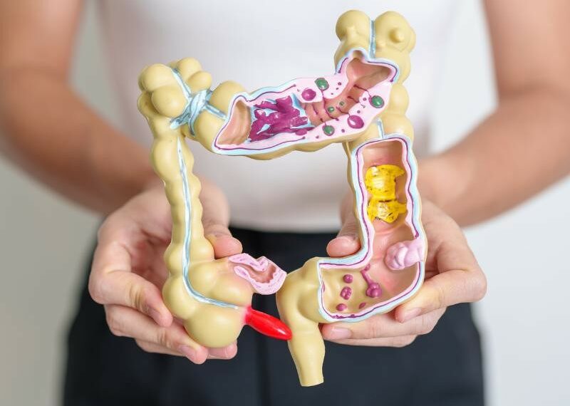 Alterações intestinais, anemia e perda de peso podem indicar câncer colorretal, alertam especialistas.
