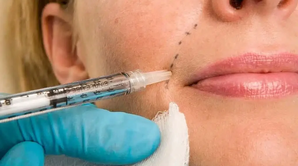 Estudo revela que preenchimentos no rosto podem bloquear artérias e causar danos permanentes, levando médicos a defender mais rigor e exames preventivos.