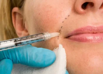 Estudo revela que preenchimentos no rosto podem bloquear artérias e causar danos permanentes, levando médicos a defender mais rigor e exames preventivos.