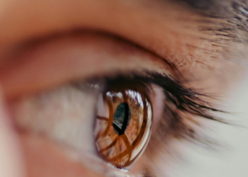 Catarata e glaucoma: entenda como essas doenças afetam a visão e quando procurar um oftalmologista