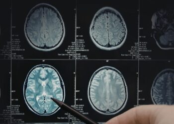 Hormônios masculinos podem estar ligados a câncer cerebral pediátrico.