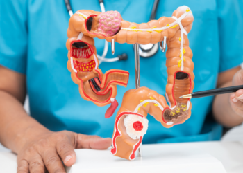 Ministério da Saúde anuncia teste para triagem do câncer de intestino
