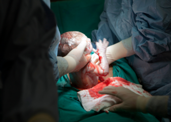 Brasil mantém alta taxa de cesarianas e vê queda dos partos vaginais no SUS. Especialistas alertam para riscos de cirurgias sem indicação médica para mães e bebês.