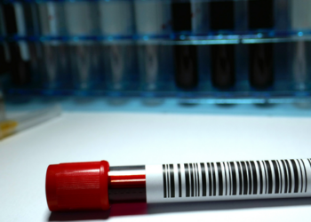 Pacientes adultos com leucemia mieloide aguda terão nova terapia disponível no SUS em até 180 dias.