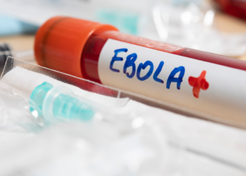 República Democrática do Congo registra aumento expressivo de casos de ebola. OMS e CDC África mobilizam plano internacional para conter o avanço da doença e reforçar sistemas de saúde.