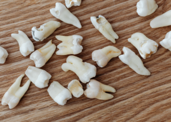 Sonhar com dente caindo, quebrado ou mole pode estar relacionado a insegurança, mudanças, comunicação e medo de perdas. Entenda os significados.