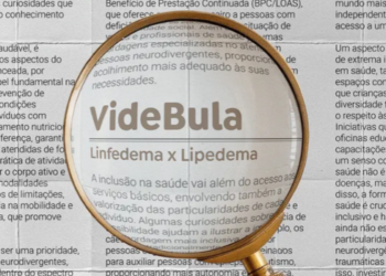 30º episódio do VideBula explica as diferenças entre linfedema e lipedema, com informações sobre sintomas, diagnóstico e tratamento.