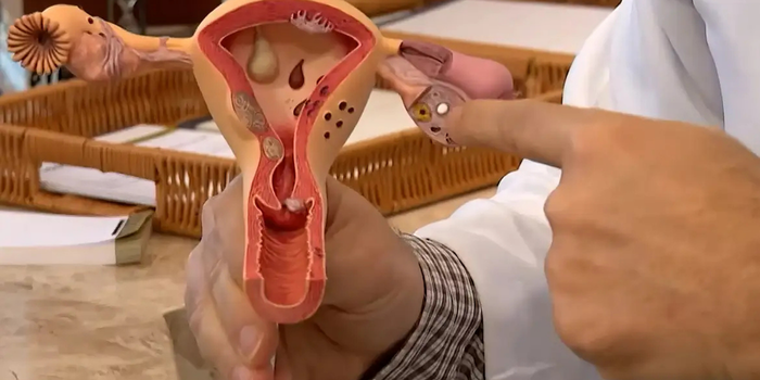 CNPq abre chamada de R$ 60 milhões para pesquisas sobre endometriose, dor pélvica e saúde menstrual. Inscrições vão até 12 de agosto.