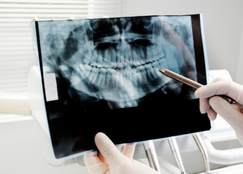 Entenda como funciona a inteligência artificial da USP desenvolvida para auxiliar dentistas.
