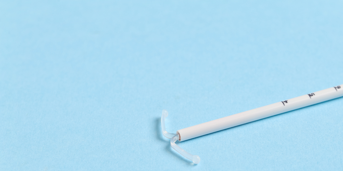 1. DIU hormonal ganha cobertura obrigatória nos planos para tratamento da endometriose em casos específicos. Entenda a nova regra.