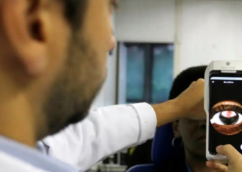 Diabetes pode provocar lesões silenciosas na retina e causar perda da visão. CBO alerta para retinopatia diabética e importância dos exames preventivos.
