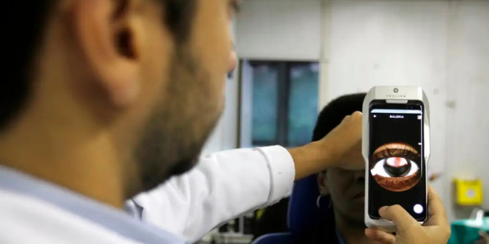 Diabetes pode provocar lesões silenciosas na retina e causar perda da visão. CBO alerta para retinopatia diabética e importância dos exames preventivos.
