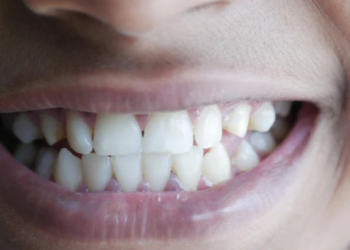 Saúde bucal vai além da dor de dente. Entenda a importância das consultas preventivas e dos cuidados diários.