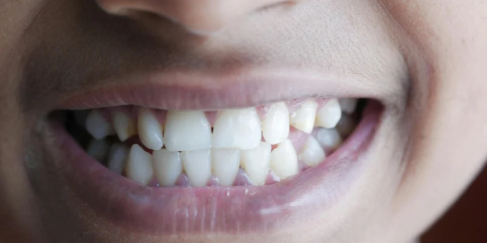Saúde bucal vai além da dor de dente. Entenda a importância das consultas preventivas e dos cuidados diários.